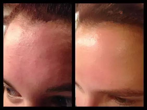 annag鍖荤編濡備綍,annag缇庡