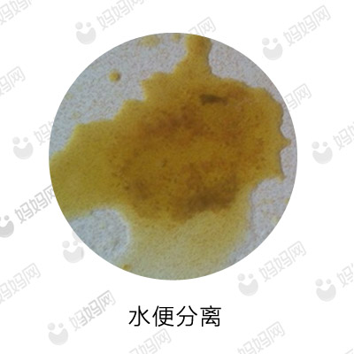 宝宝拉这几种便便要去医院,宝宝有问题的便便是怎样的