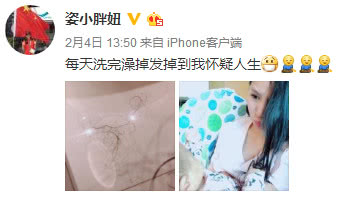 产后发际线问题有救了,产后危及发际线