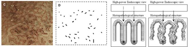 内镜检查痛苦吗,内镜检查是怎么做的