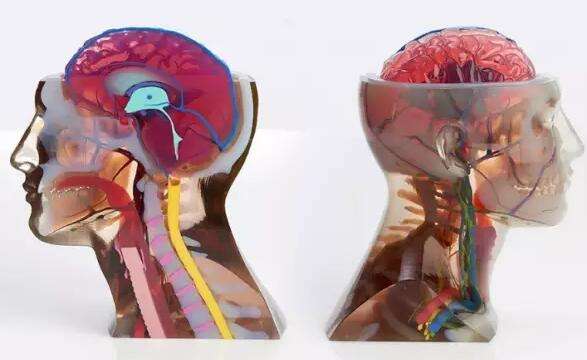 医学3d动画演示脑出血手术,3d演示脑出血治疗过程