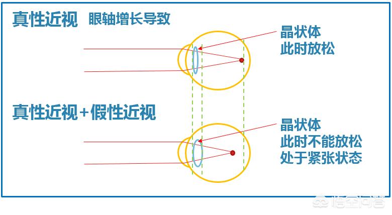 晚上如何远眺防近视,为什么远眺有助于预防近视