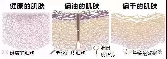 用酸会损伤了皮脂膜吗,怎么辨别自己皮脂膜受损严重不