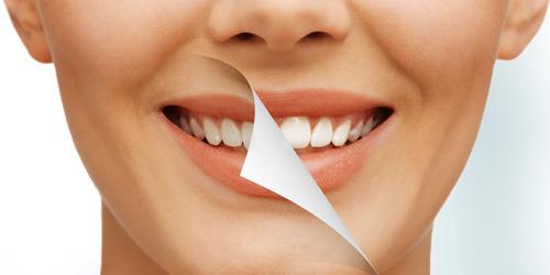 爱优牙牙齿矫正攻略,美牙中牙黄用什么处理牙齿会变白