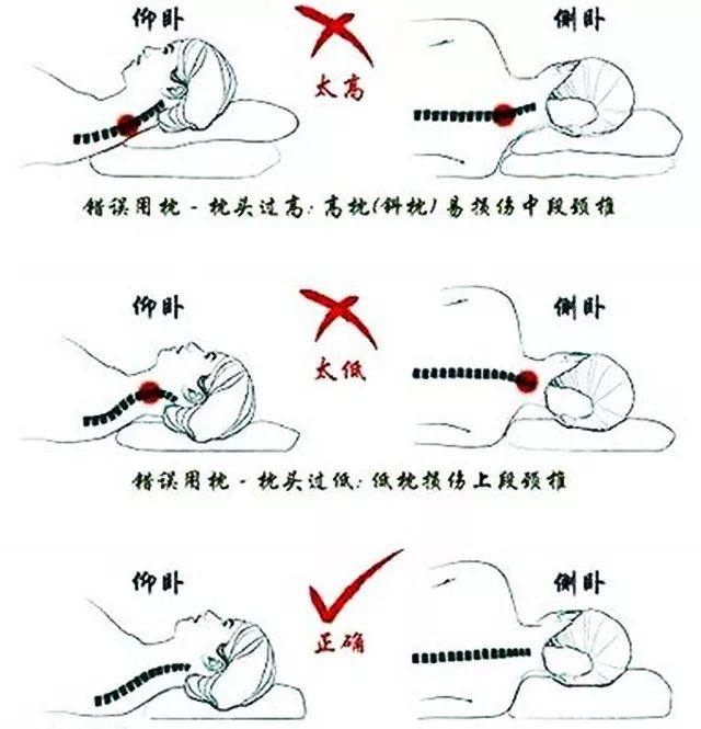 颈椎病引起的头晕该如何治疗,颈椎病引起的头晕该怎么锻炼康复