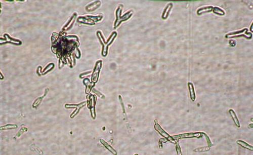 多抗霉素治疗番茄叶霉病吗,番茄叶霉病是真菌还是细菌