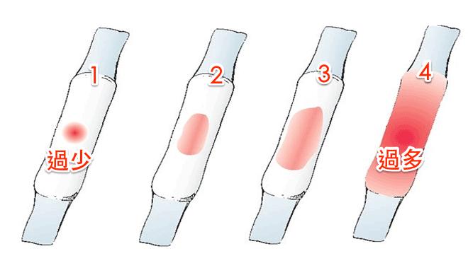 什么样的大姨妈算正常,妇产科专家咨询大姨妈