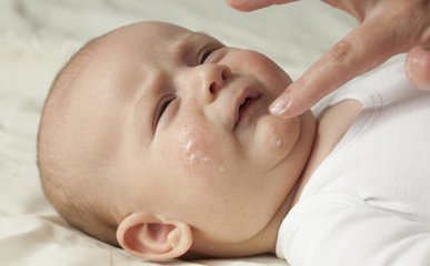 新生儿湿疹脸部症状怎么缓解,婴幼儿湿疹的症状及处理方法