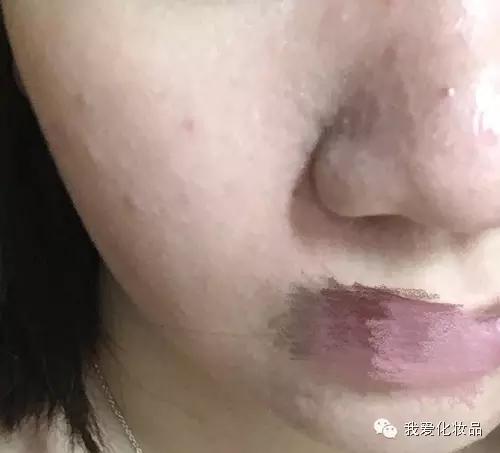 油皮痘肌适合的护肤品牌子,混油皮痘肌适用的护肤品推荐