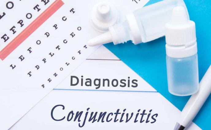 眼睛发痒说是结膜炎反反复复,一觉醒来眼睛又红又痒