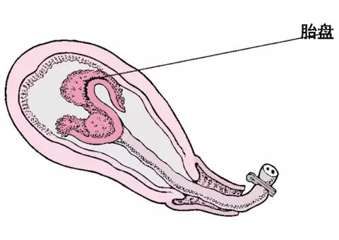 分娩过程中的三个产程过程,待产清单准妈妈们收藏起来