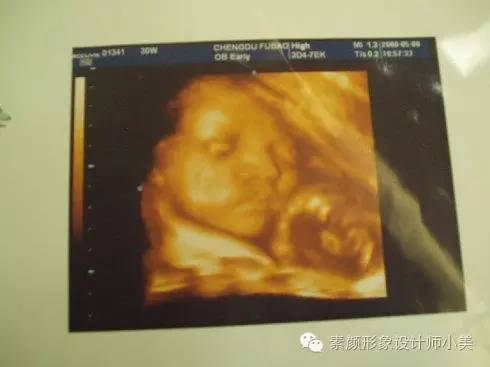 孕育知识大讲堂,怀孕九周怎么知道胎儿发育情况