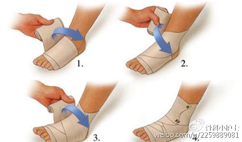 凯凯王--赵医生指导你如何处理急性踝关节扭伤！