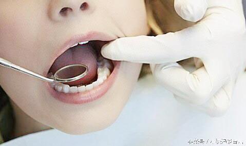 儿童乳牙龋齿烂了有必要补牙吗,乳牙蛀了是套牙套还是补牙