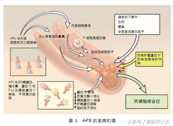 抗磷脂抗体综合症到是哪方妖怪，该怎么对付？