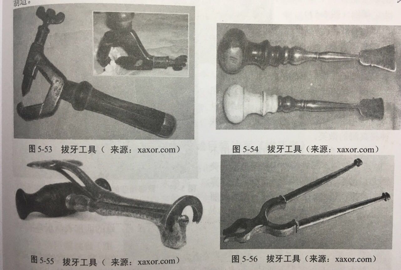 古代人遇到牙疼怎么办？