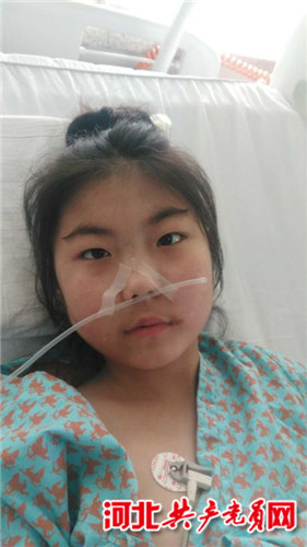 山东19岁女孩患红斑狼疮,系统性红斑狼疮女孩治疗费用