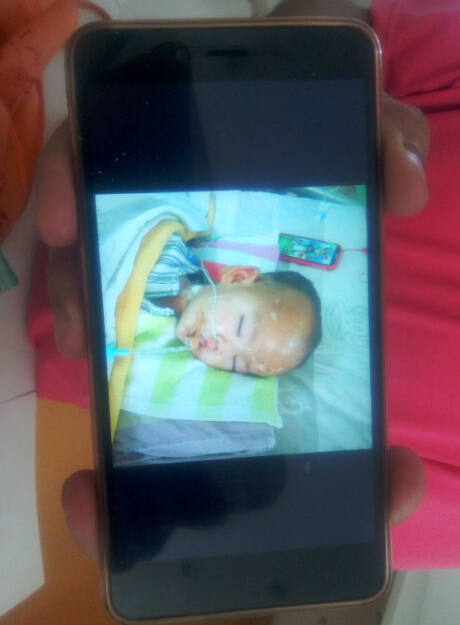 煤气罐爆炸小孩被炸伤,煤气爆炸21岁女孩被烧伤后续