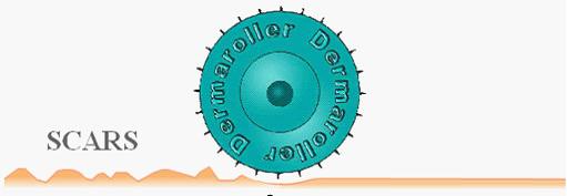 痘印难消吃什么维生素,痘印难消