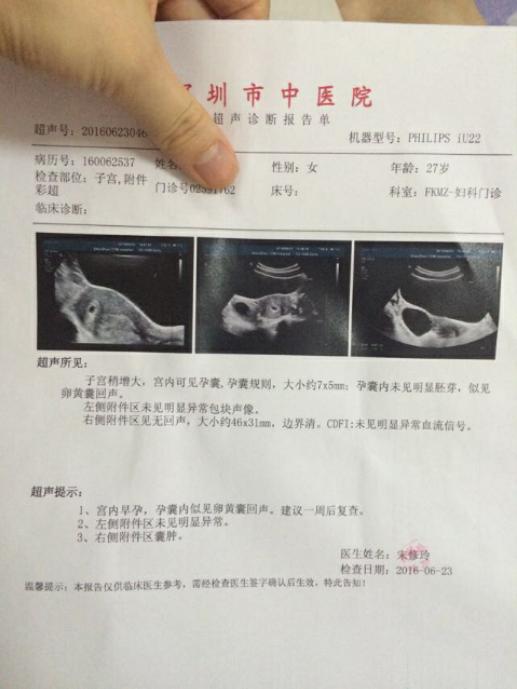 孕酮不涨流褐色物成功有胎心连医生都说是奇迹