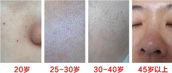 护肤100%好的妙招,橘皮护肤的正确方法