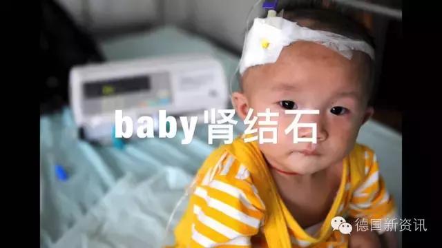 德国爱他美奶粉为什么便宜,德国爱他美奶粉几月缺货