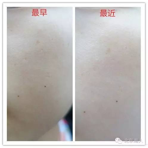 家用美容仪是怎么让皮肤好的,专业的家用美容仪该怎么用