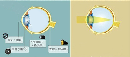 散光是怎么回事有了散光该怎么办,散光怎么引起的原因