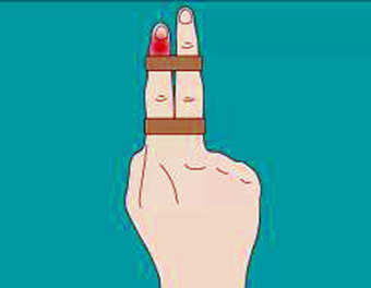 手指被注射器戳伤关节凸起怎么办,手指指根戳伤了怎么用胶带处理