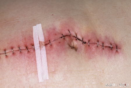 脑洞大开手术,脑洞大开手术后获得超能力