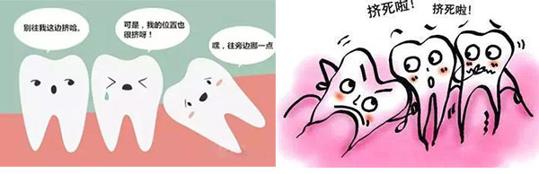 智齿发炎烦恼,智齿含牙囊肿需要尽早拔除吗