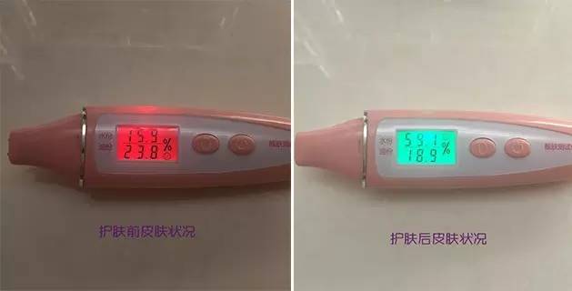 美容仪洁面仪哪个有必要入手的,性价比高的洁面仪测评