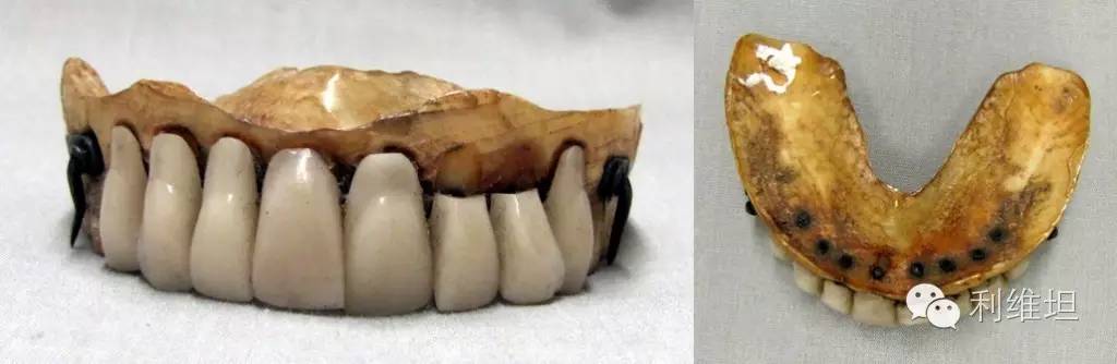 虎口拔牙之后的故事,拔牙放血的故事