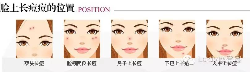 千万不要挤痘痘,挤痘痘好得快还是不挤痘痘快