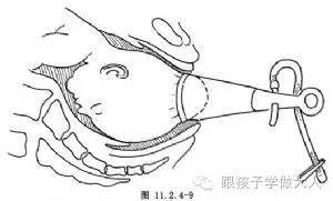 准妈产检生产都用过这些冰冷医疗仪器，看的心惊肉跳！