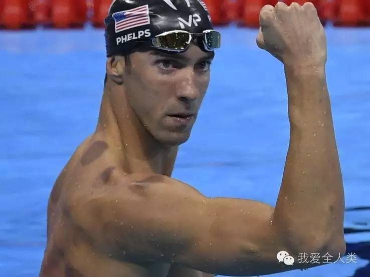 别再折腾拔罐了，中国还有其它好东西呢