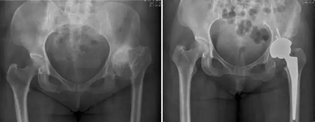 杏林秋实清华长庚骨科·关节外科中心