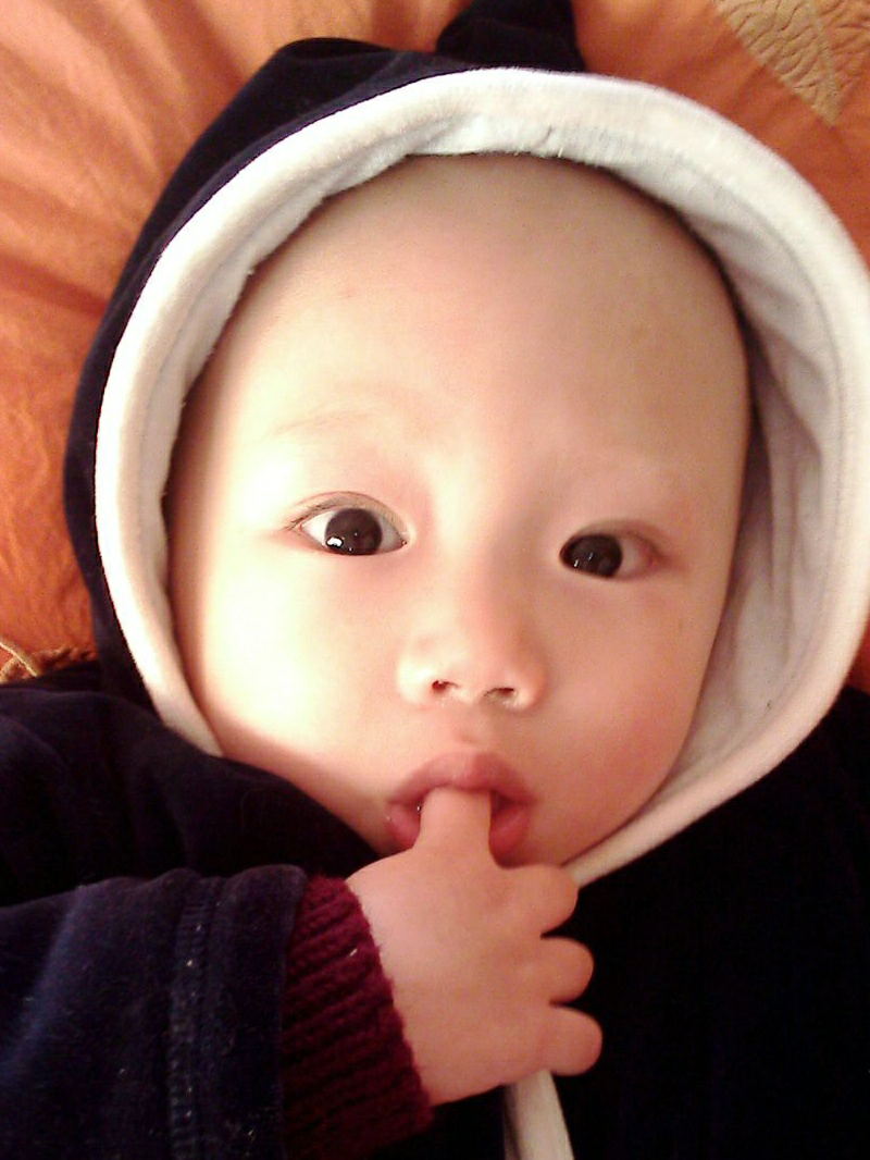 宝宝长得快容易生病,宝宝长得丑不要紧养几年就好了