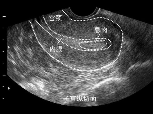 月经不调调理多久才能正常,吃药造成的月经不调能自行好吗