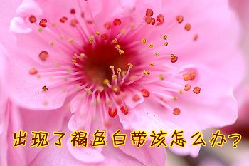 教你如何看白带报告单,如何看懂化验单白带