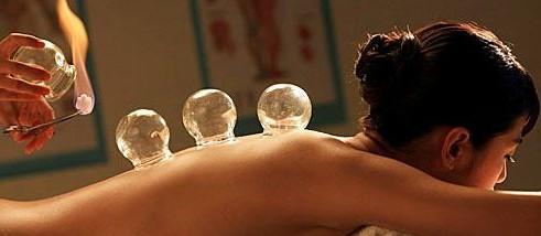 飞鱼拔罐,飞鱼菲尔普斯拔罐