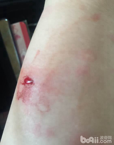 二哈狗爪子被咬了,二哈被小狗咬伤