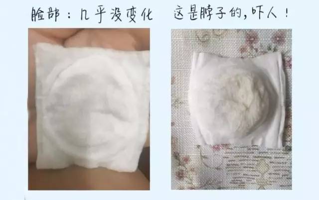 日立美容仪n4000副作用,日立美容仪n4800有用吗