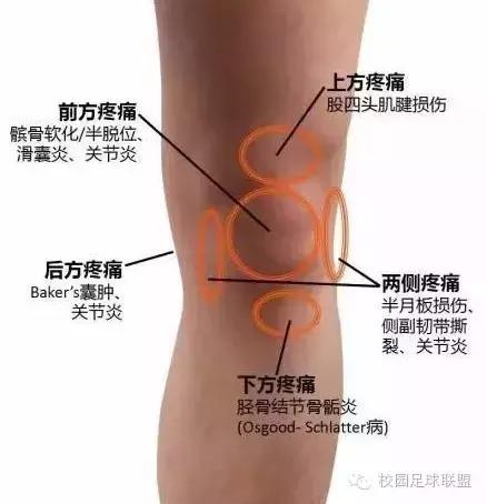 膝关节痛的危险信号,膝关节疼痛的原因及诊断思路