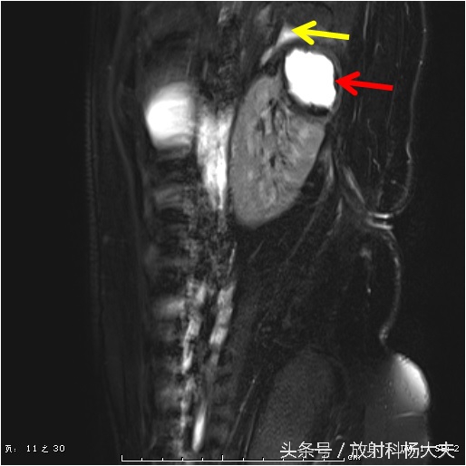 花季女孩背痛,青春期女生为什么总是腿痛
