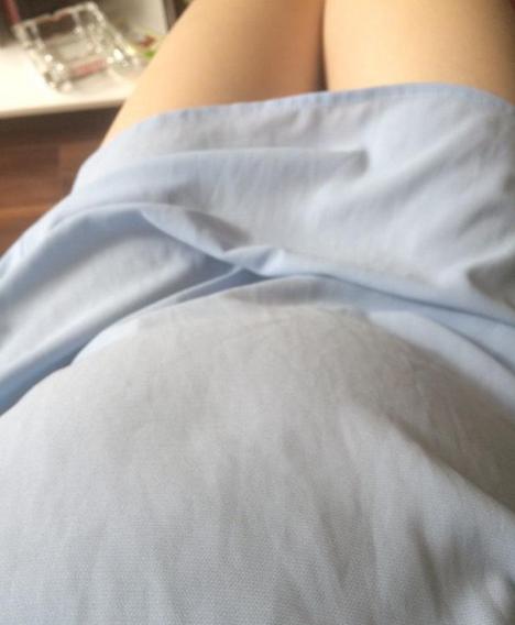 孕晚期妊娠瘙痒症原因,妊娠肝内胆汁淤积症瘙痒如何缓解