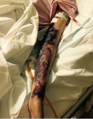 治癌症,该不该信“老中医”?