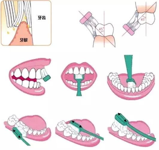 9.20全国爱牙日,每年的9月20日是全国爱牙日