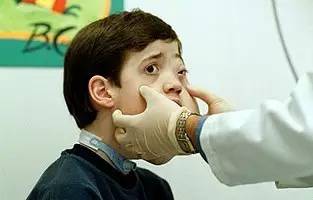 这个十四岁男孩，决定切掉自己的左脸