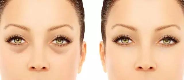 40岁眼周适合用什么样的眼霜,眼周发黑适合用什么眼霜